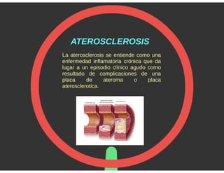 Aterosclerosis. Promoción de la salud y Prevención de la enfermedad