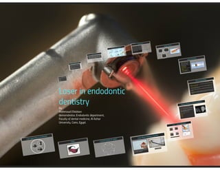 Laser in Endodontic Dentistry