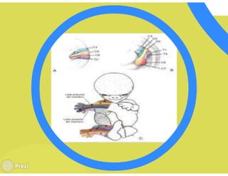 Yourprezisistemamuscular