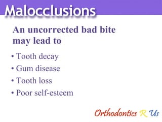 Tooth decay Gum disease Tooth loss Poor self-esteem An uncorrected bad bite  may lead to 