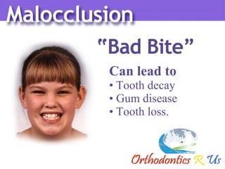 Can lead to Tooth decay Gum disease Tooth loss. 