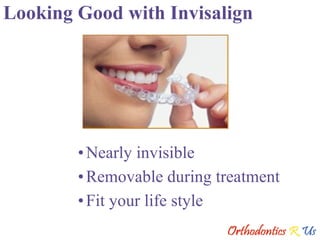 Looking Good with Invisalign Nearly invisible Removable during treatment Fit your life style 