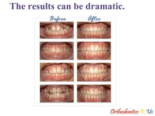 The results can be dramatic. 