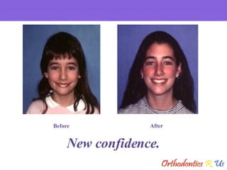 New confidence. Before After 