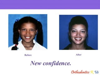 New confidence. Before After 