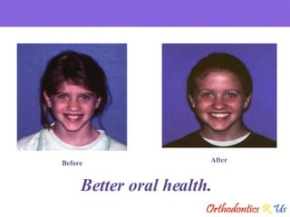 Better oral health. Before After 