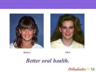 Better oral health. Before After 