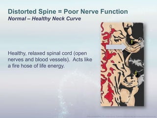 Distorted Spine = Poor Nerve Function
Normal – Healthy Neck Curve
Healthy, relaxed spinal cord (open
nerves and blood vessels). Acts like
a fire hose of life energy.
 