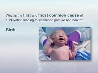 What is the first and most common cause of
subluxation leading to weakened posture and health?
Birth.
 