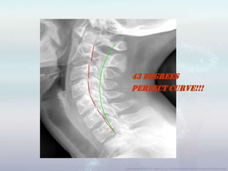 43 Degrees
Perfect Curve!!!
 