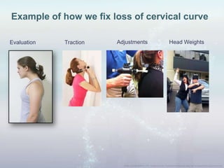 Example of how we fix loss of cervical curve
Evaluation Traction Adjustments Head Weights
 