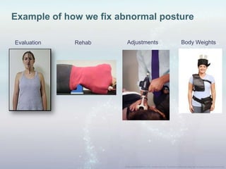 Example of how we fix abnormal posture
Evaluation Rehab Adjustments Body Weights
 