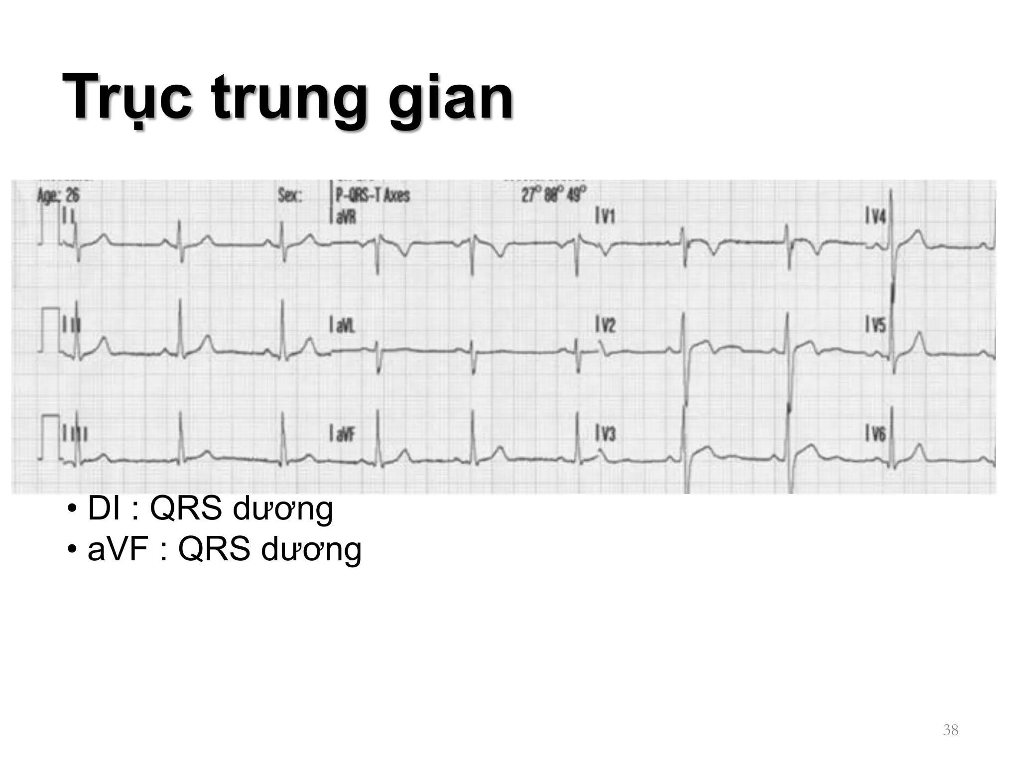 CÁC BƯỚC ĐỌC ECG | PDF