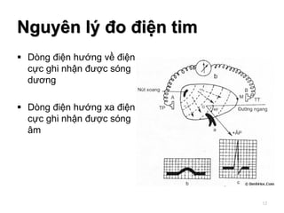 Nguyên lý đo điện tim
 Dòng điện hướng về điện
cực ghi nhận được sóng
dương
 Dòng điện hướng xa điện
cực ghi nhận được sóng
âm
12
 