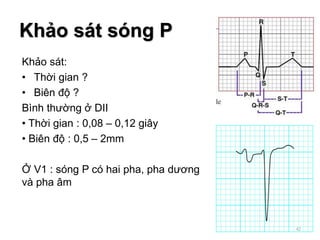 Khảo sát:
• Thời gian ?
• Biên độ ?
Bình thường ở DII
• Thời gian : 0,08 – 0,12 giây
• Biên độ : 0,5 – 2mm
Ở V1 : sóng P có hai pha, pha dương
và pha âm
Khảo sát sóng P
42
 
