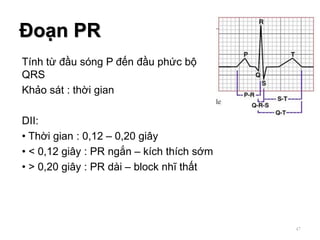 Tính từ đầu sóng P đến đầu phức bộ
QRS
Khảo sát : thời gian
DII:
• Thời gian : 0,12 – 0,20 giây
• < 0,12 giây : PR ngắn – kích thích sớm
• > 0,20 giây : PR dài – block nhĩ thất
Đoạn PR
47
 
