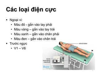 Các loại điện cực
 Ngoại vi:
• Màu đỏ - gắn vào tay phải
• Màu vàng – gắn vào tay trái
• Màu xanh – gắn vào chân phải
• Màu đen – gắn vào chân trái
 Trước ngực
• V1 – V6
5
 