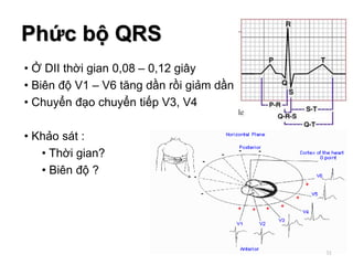 • Ở DII thời gian 0,08 – 0,12 giây
• Biên độ V1 – V6 tăng dần rồi giảm dần
• Chuyển đạo chuyển tiếp V3, V4
• Khảo sát :
• Thời gian?
• Biên độ ?
Phức bộ QRS
51
 
