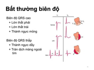 Biên độ QRS cao
+ Lớn thất phải
+ Lớn thất trái
+ Thành ngực mỏng
Biên độ QRS thấp
+ Thành ngực dầy
+ Tràn dịch màng ngoài
tim
Bất thường biên độ
56
 