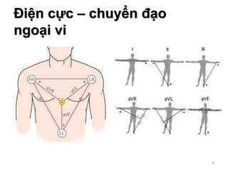 6
Điện cực – chuyển đạo
ngoại vi
6
 