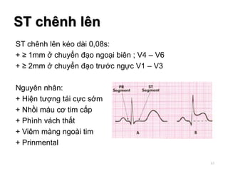 ST chênh lên kéo dài 0,08s:
+ ≥ 1mm ở chuyển đạo ngoại biên ; V4 – V6
+ ≥ 2mm ở chuyển đạo trước ngực V1 – V3
Nguyên nhân:
+ Hiện tượng tái cực sớm
+ Nhồi máu cơ tim cấp
+ Phình vách thất
+ Viêm màng ngoài tim
+ Prinmental
ST chênh lên
63
 