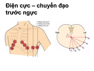 Điện cực – chuyển đạo
trước ngực
7
 