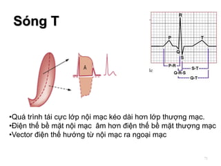 Sóng T
71
•Quá trình tái cực lớp nội mạc kéo dài hơn lớp thượng mạc.
•Điện thế bề mặt nội mạc âm hơn điện thế bề mặt thượng mạc
•Vector điện thế hướng từ nội mạc ra ngoại mạc
 