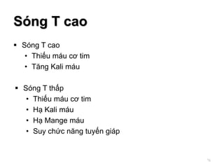 Sóng T cao
 Sóng T cao
• Thiếu máu cơ tim
• Tăng Kali máu
 Sóng T thấp
• Thiếu máu cơ tim
• Hạ Kali máu
• Hạ Mange máu
• Suy chức năng tuyến giáp
76
 
