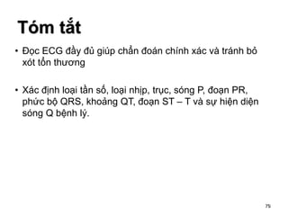 79
• Đọc ECG đầy đủ giúp chẩn đoán chính xác và tránh bỏ
xót tổn thương
• Xác định loại tần số, loại nhịp, trục, sóng P, đoạn PR,
phức bộ QRS, khoảng QT, đoạn ST – T và sự hiện diện
sóng Q bệnh lý.
Tóm tắt
79
 