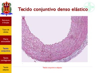 Tecido conjuntivo e adiposo
Tecido conjuntivo denso elástico
Estrutura
e função
Tipos de
células
Matriz
extracelular
Tecido
conjuntivo
Tecido
adiposo
Estrutura
e função
Tipos de
células
Matriz
extracelular
Tecido
conjuntivo
Tecido
cartilaginoso
Tecido
adiposo
 