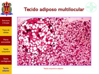 Tecido conjuntivo e adiposo
Tecido adiposo multilocular
Estrutura
e função
Tipos de
células
Matriz
extracelular
Tecido
conjuntivo
Tecido
cartilaginoso
Tecido
adiposo
 