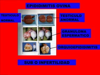 EPIDIDIMITIS OVINA
TESTICULO
NORMAL
TESTICULO
ANORMAL
GRANULOMA
ESPERMATICO
ORQUIOEPIDIDIMITIS
SUB O INFERTILIDAD
 