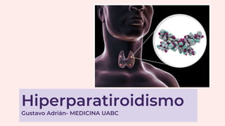 Hiperparatiroidismo
Gustavo Adrián- MEDICINA UABC
 