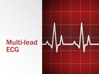 Multi-lead
ECG
 