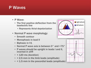 P Waves
▪ P Wave:
▪ The first positive deflection from the
isoelectric line
▪ Represents Atrial depolarization
▪ Normal P wave morphology:
▪ Smooth contour
▪ Monophasic in lead II
▪ Biphasic in V1
▪ Normal P wave axis is between 0° and +75°
▪ P waves should be upright in leads I and II,
inverted in aVR
▪ < 120 ms (duration)
▪ < 2.5 mm in the limb leads (amplitude)
▪ < 1.5 mm in the precordial leads (amplitude)
 