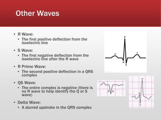 Other Waves
▪ R Wave:
▪ The first positive deflection from the
isoelectric line
▪ S Wave:
▪ The first negative deflection from the
isoelectric line after the R wave
▪ R Prime Wave:
▪ The second positive deflection in a QRS
complex
▪ QS Wave:
▪ The entire complex is negative (there is
no R wave to help identify the Q or S
wave)
▪ Delta Wave:
▪ A slurred upstroke in the QRS complex
 