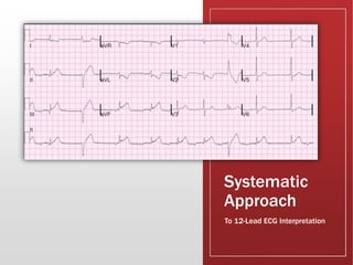 Systematic
Approach
To 12-Lead ECG Interpretation
 