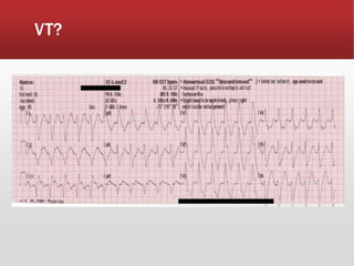 VT?
 