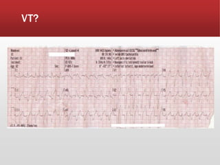 VT?
 
