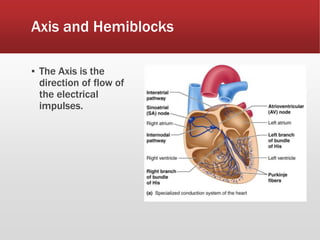 Axis and Hemiblocks
▪ The Axis is the
direction of flow of
the electrical
impulses.
 