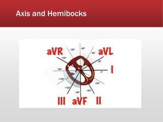 Axis and Hemibocks
 
