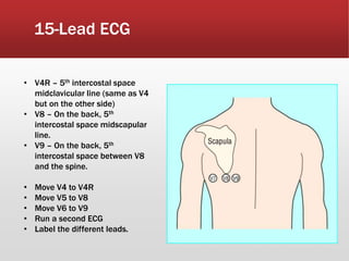 15-Lead ECG
• V4R – 5th intercostal space
midclavicular line (same as V4
but on the other side)
• V8 – On the back, 5th
intercostal space midscapular
line.
• V9 – On the back, 5th
intercostal space between V8
and the spine.
• Move V4 to V4R
• Move V5 to V8
• Move V6 to V9
• Run a second ECG
• Label the different leads.
 