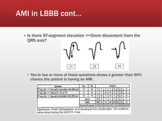 AMI in LBBB cont…
▪ Is there ST-segment elevation >=5mm discordant from the
QRS axis?
▪ Yes to two or more of these questions shows a greater than 90%
chance the patient is having an AMI.
 