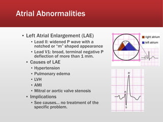 Atrial Abnormalities
▪ Left Atrial Enlargement (LAE)
▪ Lead II: widened P wave with a
notched or “m” shaped appearance
▪ Lead V1: broad, terminal negative P
deflection of more than 1 mm.
▪ Causes of LAE
▪ Hypertension
▪ Pulmonary edema
▪ LVH
▪ AMI
▪ Mitral or aortic valve stenosis
▪ Implications
▪ See causes… no treatment of the
specific problem.
 