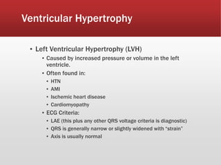 Ventricular Hypertrophy
▪ Left Ventricular Hypertrophy (LVH)
▪ Caused by increased pressure or volume in the left
ventricle.
▪ Often found in:
▪ HTN
▪ AMI
▪ Ischemic heart disease
▪ Cardiomyopathy
▪ ECG Criteria:
▪ LAE (this plus any other QRS voltage criteria is diagnostic)
▪ QRS is generally narrow or slightly widened with “strain”
▪ Axis is usually normal
 
