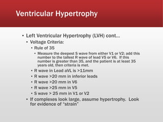 Ventricular Hypertrophy
▪ Left Ventricular Hypertrophy (LVH) cont…
▪ Voltage Criteria:
▪ Rule of 35
▪ Measure the deepest S wave from either V1 or V2; add this
number to the tallest R wave of lead V5 or V6. If this
number is greater than 35, and the patient is at least 35
years old, then criteria is met.
▪ R wave in Lead aVL is >11mm
▪ R wave >20 mm in inferior leads
▪ R wave >20 mm in V6
▪ R wave >25 mm in V5
▪ S wave > 25 mm in V1 or V2
▪ If complexes look large, assume hypertrophy. Look
for evidence of “strain”
 