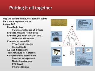 Putting it all together
Prep the patient (shave, dry, position, calm)
Place leads in proper places
Analyze ECG
Identify rhythm
If wide complex use VT criteria
Evaluate Axis and Hemiblocks
Evaluate QRS width in V1 for BBB
LBBB and AMI criteria
Evaluate for acute MI
ST segment changes
I see all leads
15 lead if necessary
Treat for Acute MI if present
Comprehensive assessment
Chamber enlargement
Electrolyte changes
QT interval
Other conditions
 