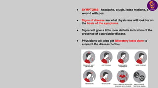● SYMPTOMS- headache, cough, loose motions, a
wound with pus.
● Signs of disease are what physicians will look for on
the basis of the symptoms.
● Signs will give a little more definite indication of the
presence of a particular disease.
● Physicians will also get laboratory tests done to
pinpoint the disease further.
 