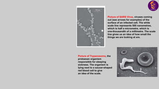 Picture of SARS Virus, viruses coming
out (see arrows for examples) of the
surface of an infected cell. The white
scale line represents 500 nanometres,
which is half a micrometre, which is
one-thousandth of a millimetre. The scale
line gives us an idea of how small the
things we are looking at are.
Picture of Trypanosoma, the
protozoan organism
responsible for sleeping
sickness. The organism is
lying next to a saucer-shaped
red blood cell to give
an idea of the scale.
 