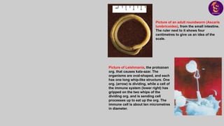 Picture of an adult roundworm (Ascaris
lumbricoides), from the small intestine.
The ruler next to it shows four
centimetres to give us an idea of the
scale.
Picture of Leishmania, the protozoan
org. that causes kala-azar. The
organisms are oval-shaped, and each
has one long whip-like structure. One
org. (arrow) is dividing, while a cell of
the immune system (lower right) has
gripped on the two whips of the
dividing org. and is sending cell
processes up to eat up the org. The
immune cell is about ten micrometres
in diameter.
 